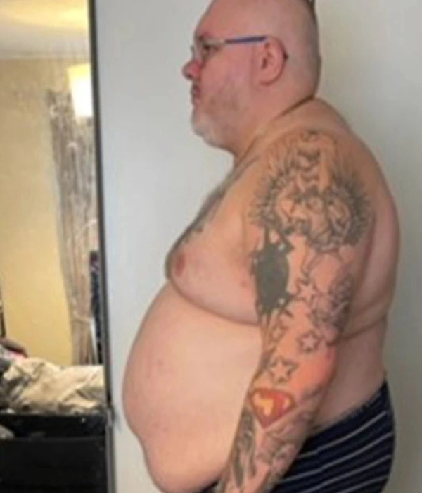danny dunning before