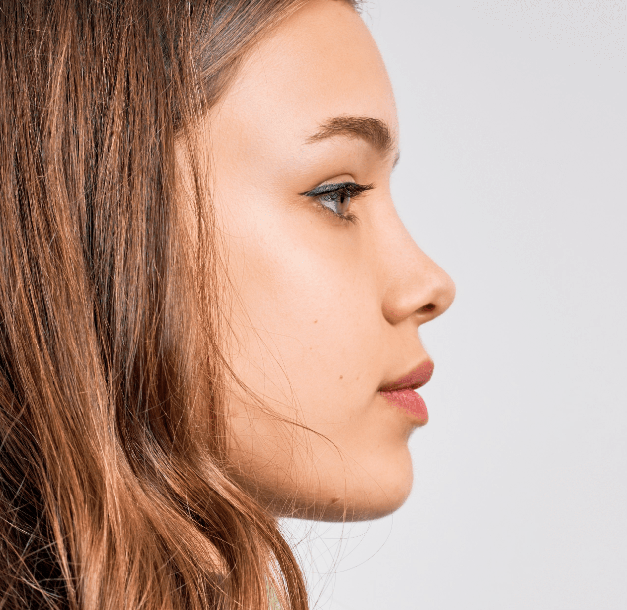 cheek-chin-jaw-implants-variation-1