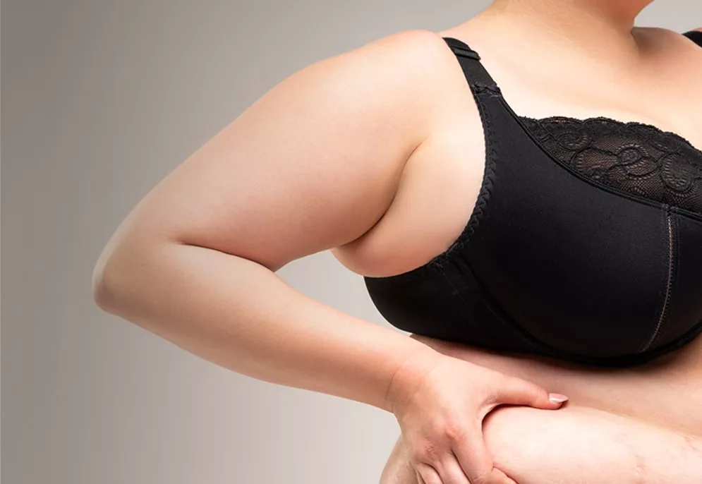 LIPOSUCTION: SURGICAL OR NON-SURGICAL?