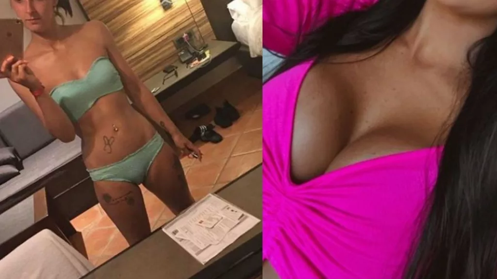 Jordan's breast augmentation story